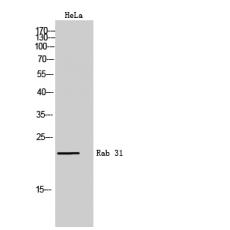 Anti-Rab 31 antibody