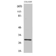 Anti-Rab 6C antibody