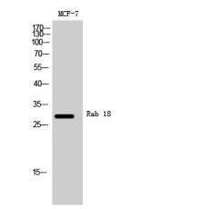 Anti-Rab 18 antibody