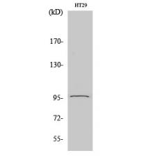 Anti-PSMD2 antibody