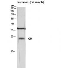 Anti-QM antibody