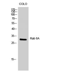 Anti-Rab 6A antibody