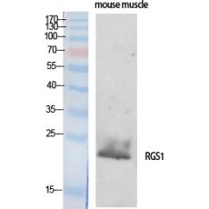 Anti-RGS1 antibody
