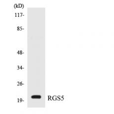 Anti-RGS5 antibody
