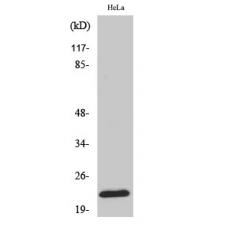 Anti-Ribosomal Protein L18 antibody