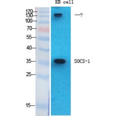 Anti-SOCS-1 antibody