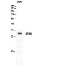 Anti-Spindlin-1 antibody
