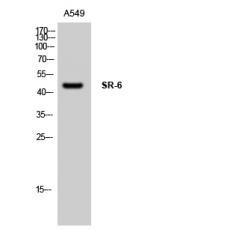Anti-SR-6 antibody