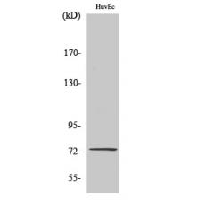 Anti-SSH3 antibody