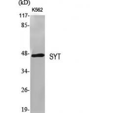 Anti-SYT antibody