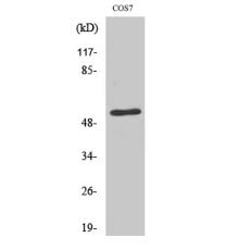 Anti-TADA2L antibody