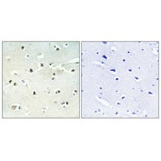 Anti-S-100A16 antibody