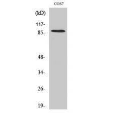 Anti-SENP5 antibody