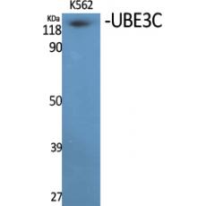 Anti-UBE3C antibody