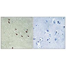 Anti-NXF3 antibody