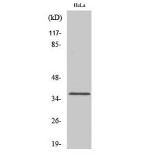 Anti-Olfactory receptor 1D4/1D5 antibody