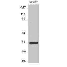 Anti-Olfactory receptor 1B1 antibody