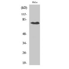 Anti-OATP1 antibody