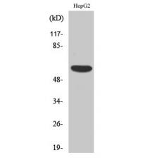Anti-OY-TES-1 antibody