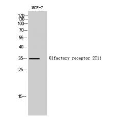 Anti-Olfactory receptor 2T11 antibody
