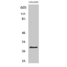 Anti-PGLS antibody