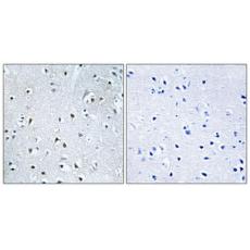Anti-POLDIP3 antibody