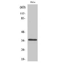 Anti-Olfactory receptor 8J3 antibody