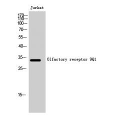 Anti-Olfactory receptor 9Q1 antibody