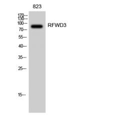 Anti-RFWD3 antibody