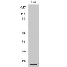 Anti-PTH antibody