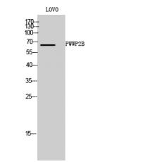 Anti-PWWP2B antibody
