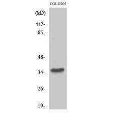 Anti-Rab 37 antibody