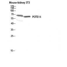 Anti-POTE15 antibody