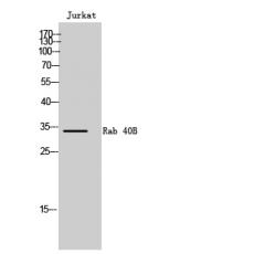 Anti-Rab 40B antibody