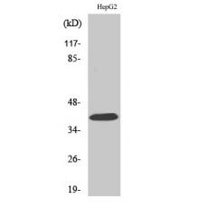 Anti-PAR-4 antibody