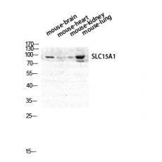 Anti-PEPT1 antibody