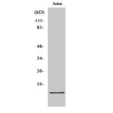 Anti-PDRG1 antibody