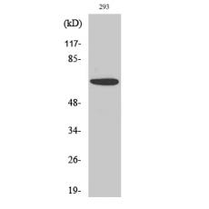 Anti-PAKα antibody