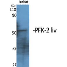 Anti-PFK-2 liv antibody