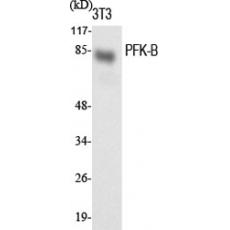 Anti-PFK-B antibody
