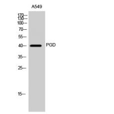 Anti-PGD antibody