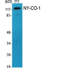 Anti-NY-CO-1 antibody