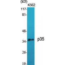 Anti-p35 antibody