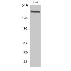 Anti-UBR5 antibody