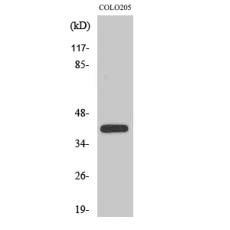Anti-XPA antibody