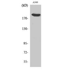 Anti-ZC3H13 antibody