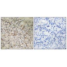 Anti-UROC28 antibody