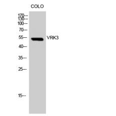 Anti-VRK3 antibody