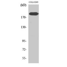 Anti-XPG antibody