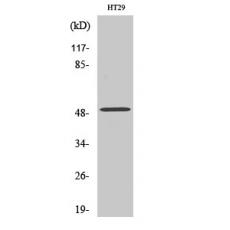 Anti-ZFYVE19 antibody